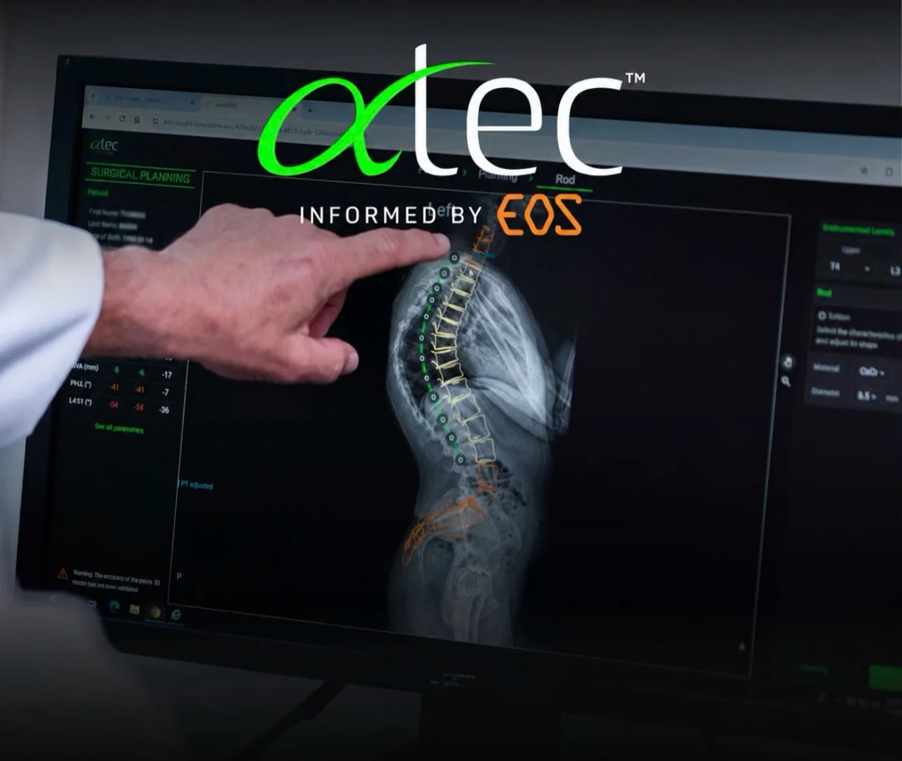 ATEC branding above a surgical planning screen displaying a spinal image and alignment measurements.